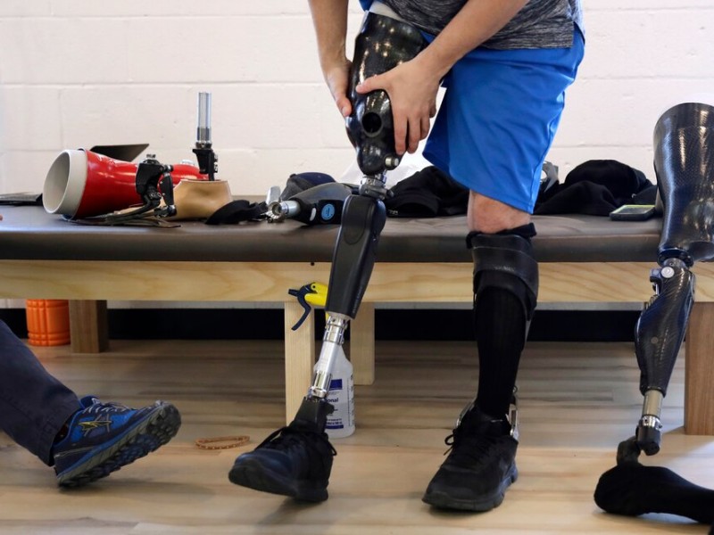 Prosthetics