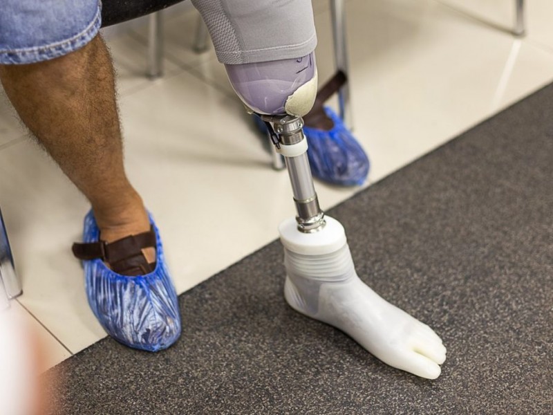 Prosthetic Feet